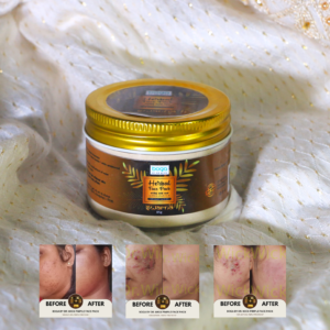 Doctor-Formulated Face Pack For Pimple Skin - Boga By Dr.Wick